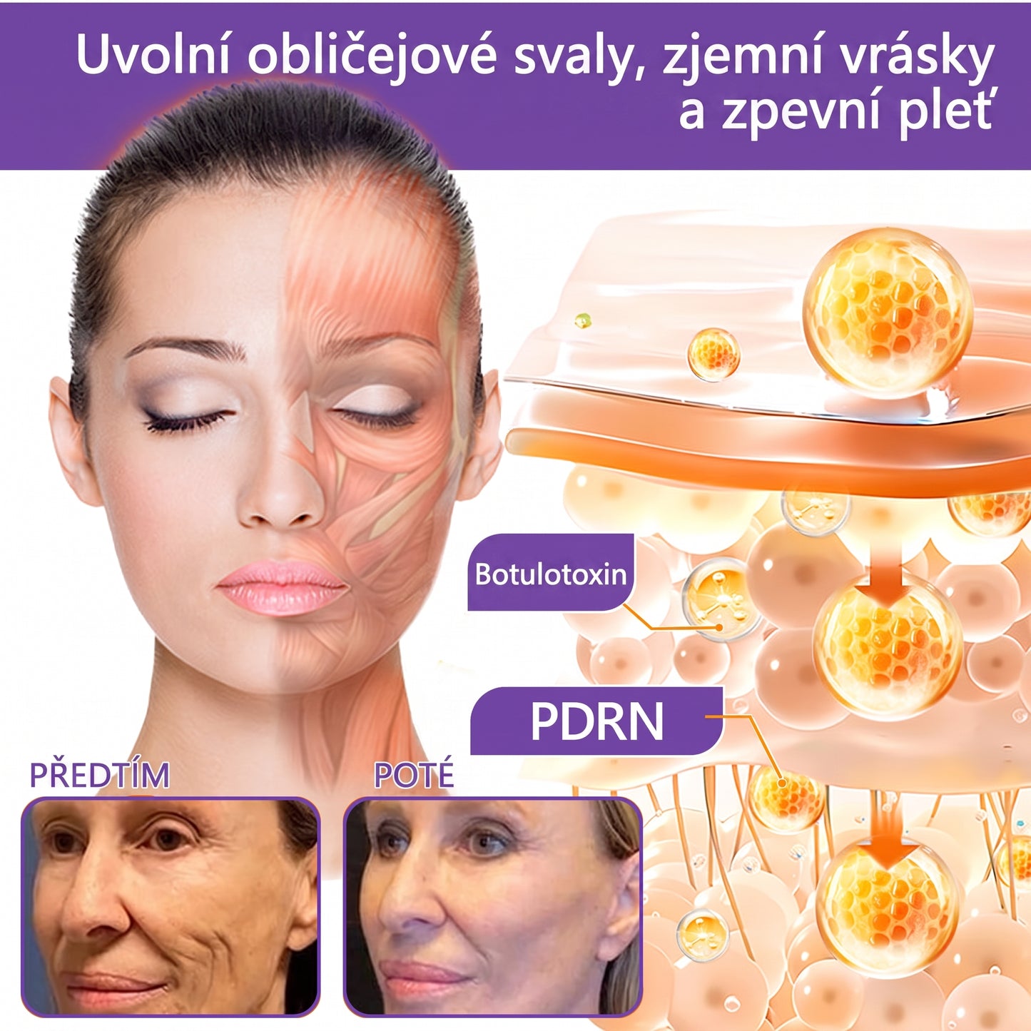 Doporučováno dermatology🥇 | 🍍Vitalisys® PDRN Multi-Peptidový masážní tělový krém – Proti stárnutí, hydratační, zpevňující, regenerační, sjednocující, proti akné a skvrnám, na odstraňování bradavic a mateřských znamének, pro úlevu při lupénce.❤️