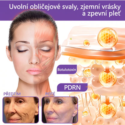 Doporučováno dermatology🥇 | 🍍Vitalisys® PDRN Multi-Peptidový masážní tělový krém – Proti stárnutí, hydratační, zpevňující, regenerační, sjednocující, proti akné a skvrnám, na odstraňování bradavic a mateřských znamének, pro úlevu při lupénce.❤️