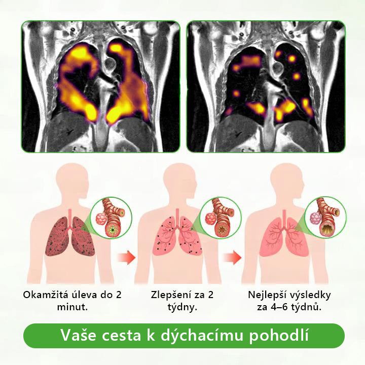 🇨🇿 České vlastnictví a správa ✅ Murwon® bylinný difuzér pro čištění plic s diviznou (Mullein)  🫁 (kašel, faryngitida, dušnost, hlen, ucpaný nos, bronchitida, alergické příznaky, nepohodlí v plicích) 🌷