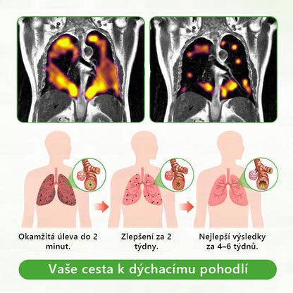 🇨🇿 České vlastnictví a správa ✅ Murwon® bylinný difuzér pro čištění plic s diviznou (Mullein)  🫁 (kašel, faryngitida, dušnost, hlen, ucpaný nos, bronchitida, alergické příznaky, nepohodlí v plicích) 🌷