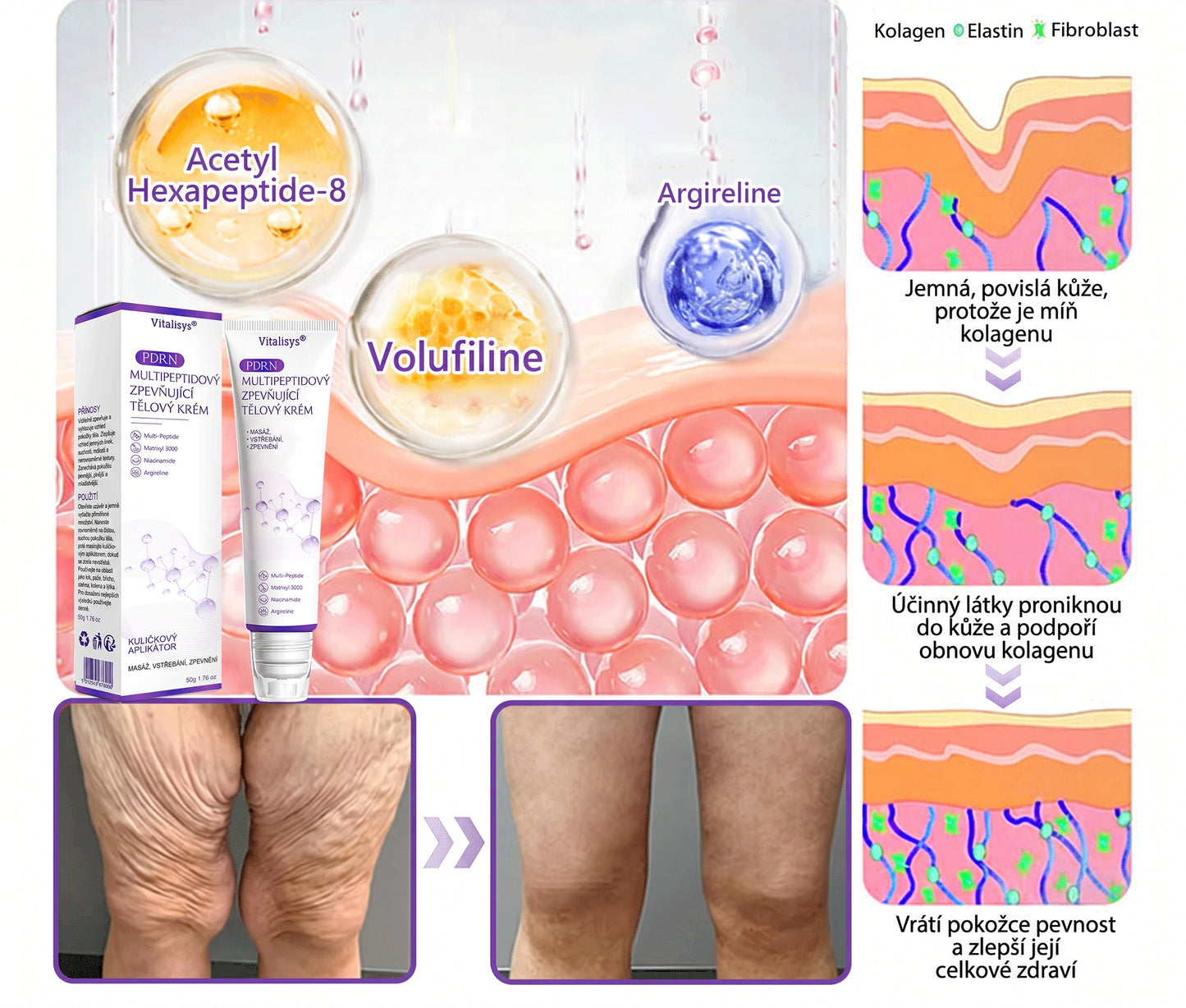 Doporučováno dermatology🥇 | 🍍Vitalisys® PDRN Multi-Peptidový masážní tělový krém – Proti stárnutí, hydratační, zpevňující, regenerační, sjednocující, proti akné a skvrnám, na odstraňování bradavic a mateřských znamének, pro úlevu při lupénce.❤️
