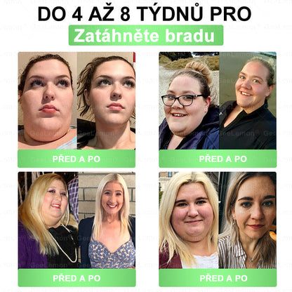 𝐇𝐞𝐚𝐥𝐫𝐢𝐳𝐞® Glum𝐚𝐬𝐞tide 8 v 1 – Zeštíhlující nano  mikrojihlový náplast 🇨🇿 Jen 1× denně  Viditelné změny za 7 dní – na obezitu, kardiovaskulární zdraví, diabetes a kloubní problémyhua