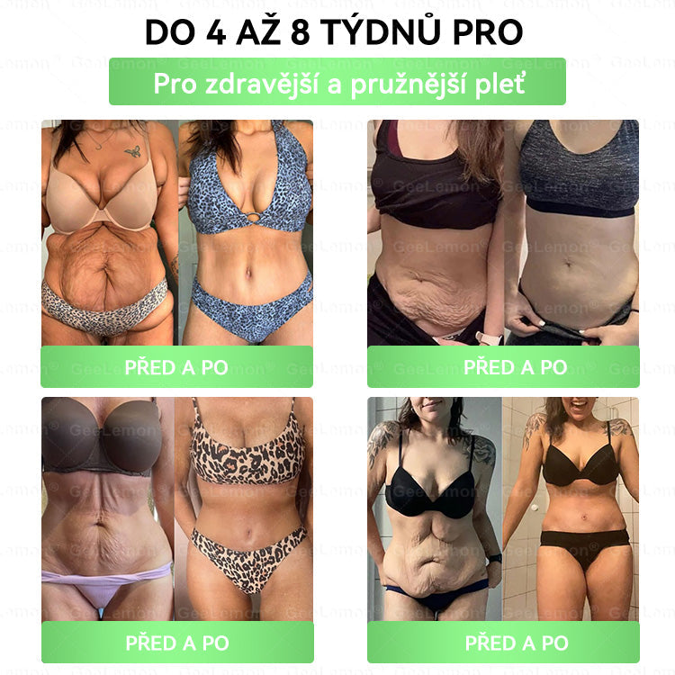 𝐇𝐞𝐚𝐥𝐫𝐢𝐳𝐞® Glum𝐚𝐬𝐞tide 8 v 1 – Zeštíhlující nano  mikrojihlový náplast 🇨🇿 Jen 1× denně  Viditelné změny za 7 dní – na obezitu, kardiovaskulární zdraví, diabetes a kloubní problémyhua