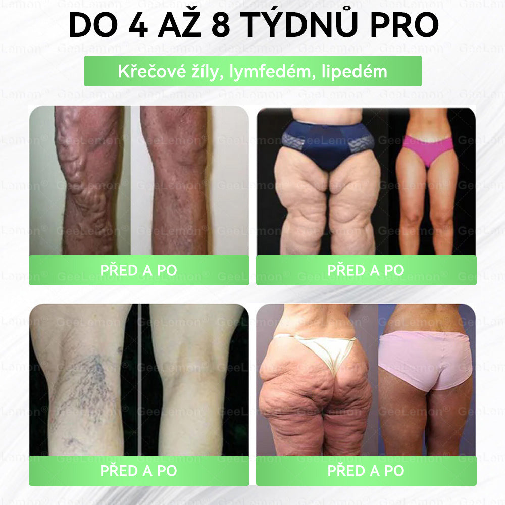 𝐇𝐞𝐚𝐥𝐫𝐢𝐳𝐞® Glum𝐚𝐬𝐞tide 8 v 1 – Zeštíhlující nano  mikrojihlový náplast 🇨🇿 Jen 1× denně  Viditelné změny za 7 dní – na obezitu, kardiovaskulární zdraví, diabetes a kloubní problémyhua