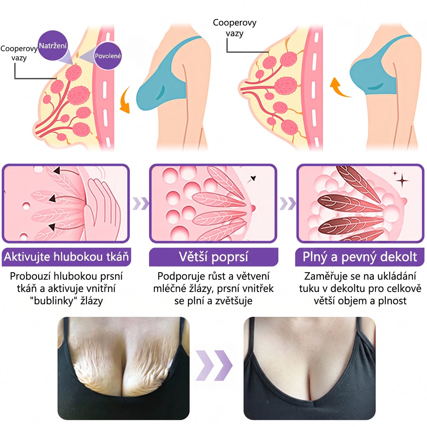 Doporučováno dermatology🥇 | 🍍Vitalisys® PDRN Multi-Peptidový masážní tělový krém – Proti stárnutí, hydratační, zpevňující, regenerační, sjednocující, proti akné a skvrnám, na odstraňování bradavic a mateřských znamének, pro úlevu při lupénce.❤️