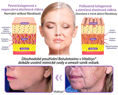 Doporučováno dermatology🥇 | 🍍Vitalisys® PDRN Multi-Peptidový masážní tělový krém – Proti stárnutí, hydratační, zpevňující, regenerační, sjednocující, proti akné a skvrnám, na odstraňování bradavic a mateřských znamének, pro úlevu při lupénce.❤️