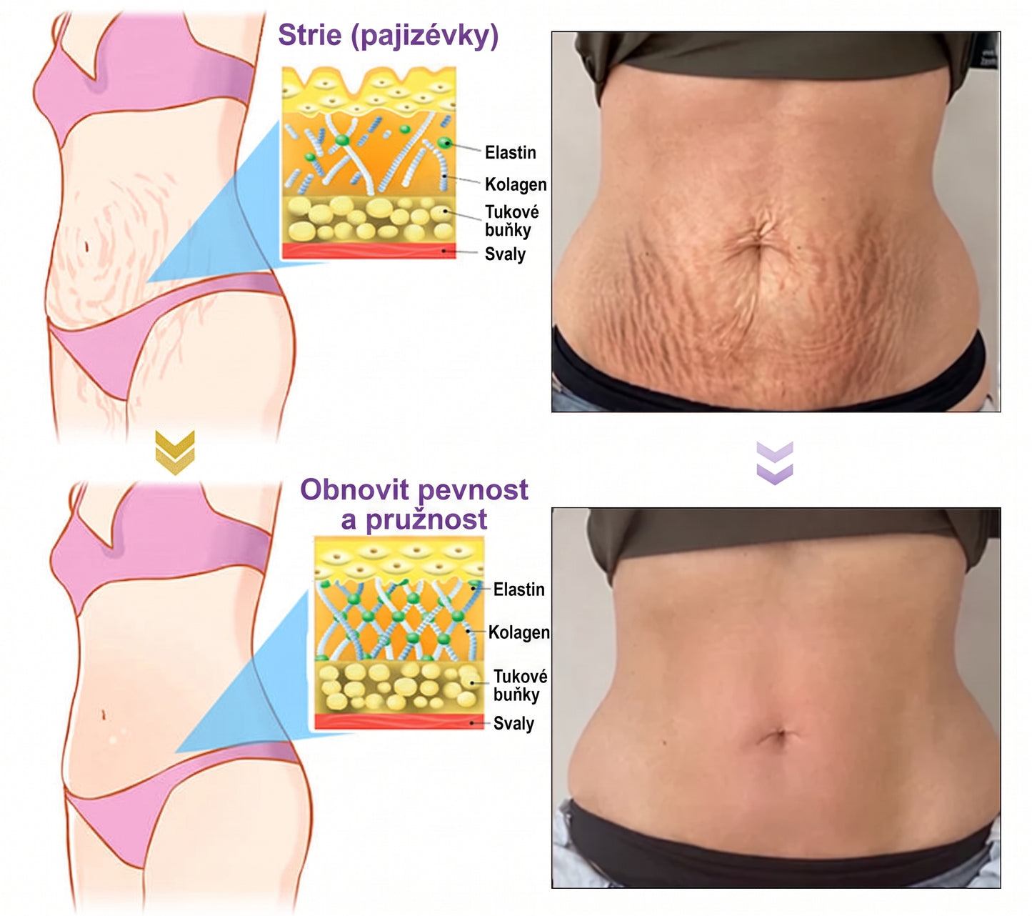 Doporučováno dermatology🥇 | 🍍Vitalisys® PDRN Multi-Peptidový masážní tělový krém – Proti stárnutí, hydratační, zpevňující, regenerační, sjednocující, proti akné a skvrnám, na odstraňování bradavic a mateřských znamének, pro úlevu při lupénce.❤️