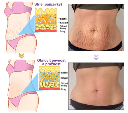 Doporučováno dermatology🥇 | 🍍Vitalisys® PDRN Multi-Peptidový masážní tělový krém – Proti stárnutí, hydratační, zpevňující, regenerační, sjednocující, proti akné a skvrnám, na odstraňování bradavic a mateřských znamének, pro úlevu při lupénce.❤️