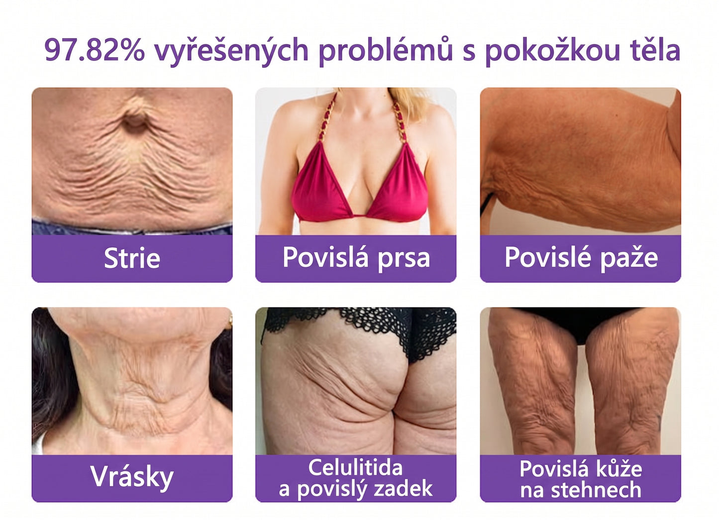 Doporučováno dermatology🥇 | 🍍Vitalisys® PDRN Multi-Peptidový masážní tělový krém – Proti stárnutí, hydratační, zpevňující, regenerační, sjednocující, proti akné a skvrnám, na odstraňování bradavic a mateřských znamének, pro úlevu při lupénce.❤️