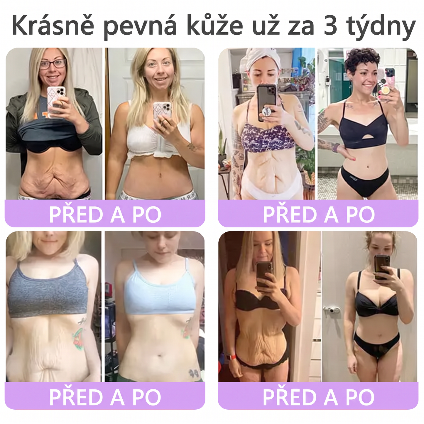 Doporučováno dermatology🥇 | 🍍Vitalisys® PDRN Multi-Peptidový masážní tělový krém – Proti stárnutí, hydratační, zpevňující, regenerační, sjednocující, proti akné a skvrnám, na odstraňování bradavic a mateřských znamének, pro úlevu při lupénce.❤️