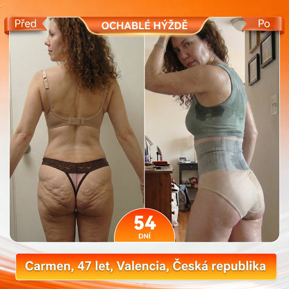 Oficiální značkový e-shop 👑 BLUESHOT® 2026 – Moringa & Berberin: Tvarující šortky 4 v 1 s mikročásticemi pro spalování tuků🧡