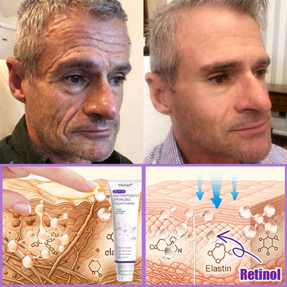 Doporučováno dermatology🥇 | 🍍Vitalisys® PDRN Multi-Peptidový masážní tělový krém – Proti stárnutí, hydratační, zpevňující, regenerační, sjednocující, proti akné a skvrnám, na odstraňování bradavic a mateřských znamének, pro úlevu při lupénce.❤️